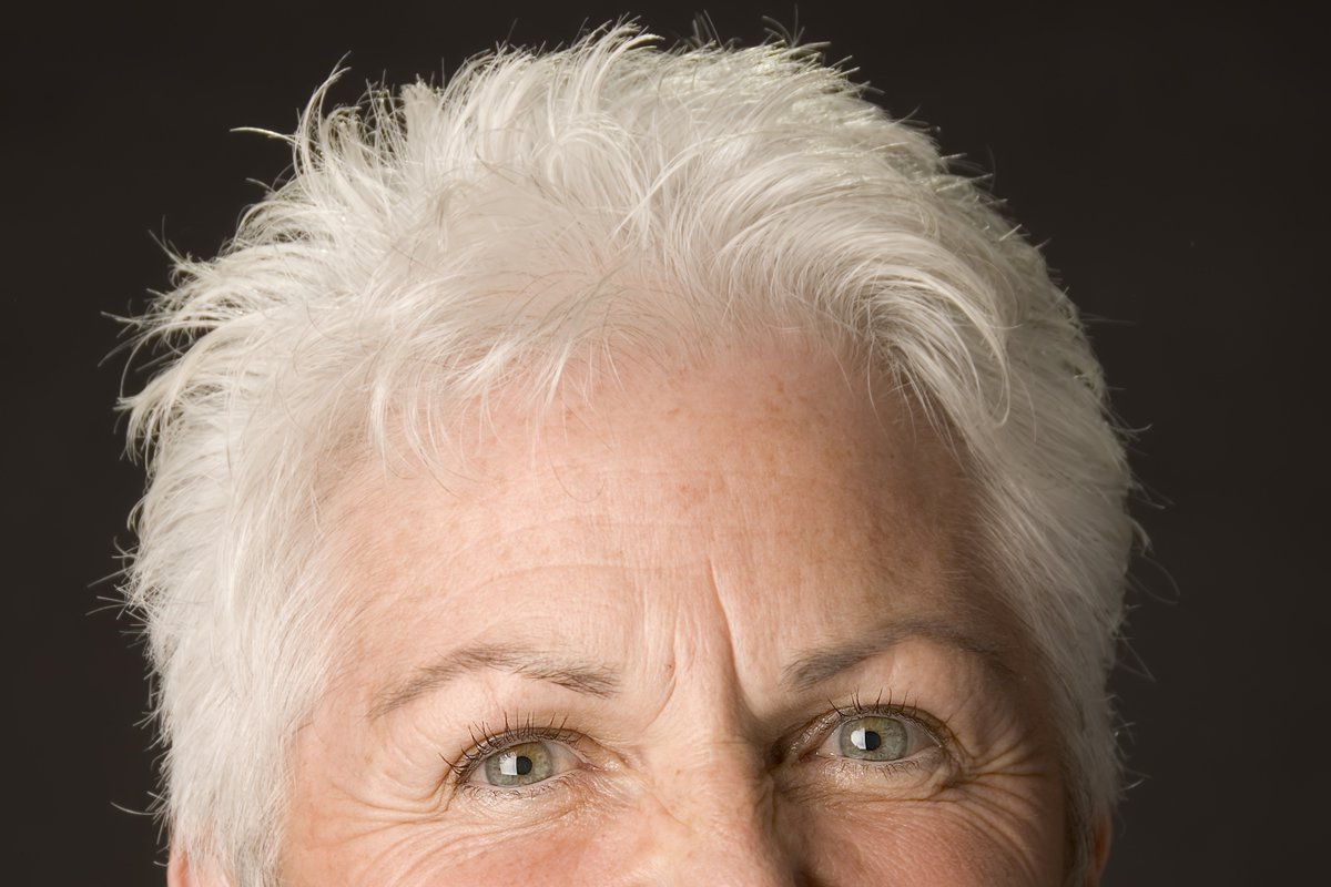 Portret starszej kobiety z zaznaczonymi zmarszczkami czoła — lifting czoła